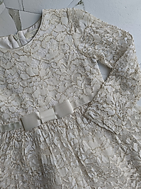 Transparan kol dantel elbise